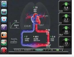 وبینار پایش های مهم در بیماران بخش های مراقبت ویژه (Monitoring in ICU Patients)