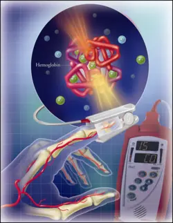 وبینار پایش های تنفسی در بیماران کووید19(Respiratory Monitoring in COVID-19 Patients)