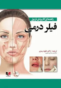 راهنمای کاربردی تزریق فیلر درمی-رمزی/آبادیس طب
