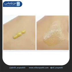 کرم تیوپی درمانی ضد جوش و آکنه اورژانسی بیوآکوا کد BQY7626