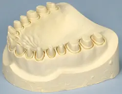 گچ دندانپزشکی
