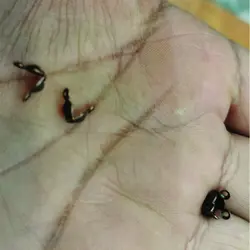 بست گره مخفی کن مسی آلما مد