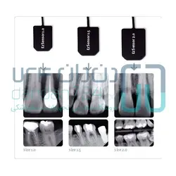 سنسور RVG سایز 1.5 واتک (Vatech) مدل EZ Sensor HD - دندان 724 | فروشگاه اینترنتی تجهیزات دندانپزشکی