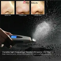 دستگاه اتوى صورت و بدن درما اف دیجیتال Digital Derma F skin scruber