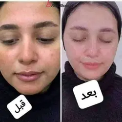 کرم سفید کننده کلاژن شیر الاغ