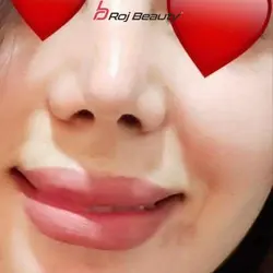 چسب لیفت بینی باریک اصل کره