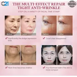 سرم آبرسان ونزن مدل خاویار VEZEحجم 100 میلی لیتر