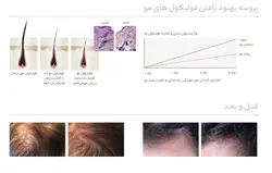 کوکتل ضد ریزش مو آنوبیس مد ۱۰ میل