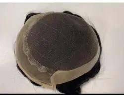 پروتز جلو تور هالیوودی