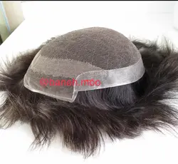 پروتز جلو تور هالیوودی