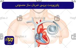 پاورپوینت بررسی ضربان ساز مصنوعی
