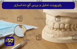 پاورپوینت تحلیل و بررسی گچ دندانسازی
