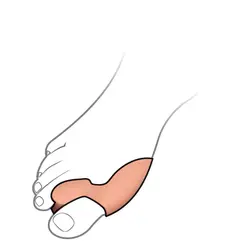 پد فاصله دهنده تک انگشت با ساپورت شست سیلیکونی اتسی OTESSY TF03