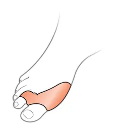پد فاصله دهنده دو انگشت با ساپورت شست اتسی OTESSY TF02