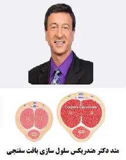 متد دکتر هندریکس سلول سازی بافت اسفنجی پرفروش ترین روش دنیا