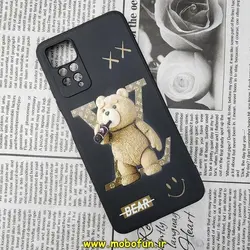 قاب گوشی Xiaomi Redmi Note 11 Pro 4G Global - Redmi Note 11 Pro 5G Global شیائومی سیلیکونی ژله ای محافظ لنز دار طرح خرسی تدی Tedi مشکی کد 275