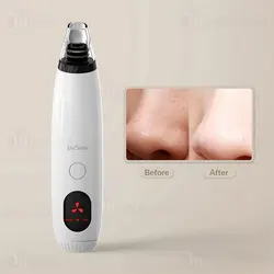 میکرودرم شیائومی Xiaomi Enchen Blackhead Remover EB1001