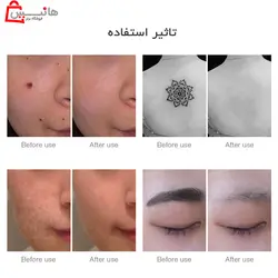 لیزر قلمی نت سل نور آبی NEATCELL