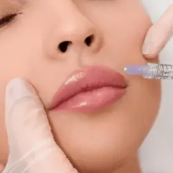 فیلر (ژل) سطح 2 کلینیک اسکینوب