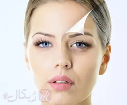 پک کربوکسی تراپی برند ویونسا VIYONSA (20 نفره)