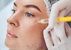 کوکتل شبه بوتاکس فیوژن F-BTX