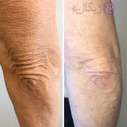 روغن هات فلاکس ضد سلولیت دکاسو 1000 میلی لیتر