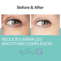 ژل تخصصی کافئین و کلاژن فیورنزا حجم 120 میلی لیتر