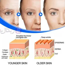 ویال ضد لک و ضد پیری پوست نیاسینامید West&Month بسته 7 عددی