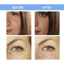 ویال ضد لک و ضد پیری پوست نیاسینامید West&Month بسته 7 عددی