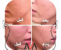 پاکسازی پوست صورت وگردن
