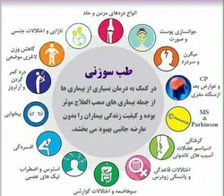 طب سوزنی(درمانی،لاغری،زیبایی)