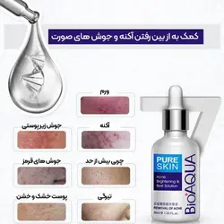 سرم و کرم ضد جوش بیوآکوا