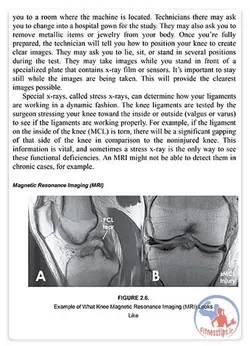 کتاب آسیب های زانو در ورزش و پیشگیری از صدمات شایع