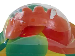 دندان مصنوعی یک طرف