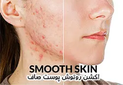 اکشن روتوش پوست صاف برای فتوشاپ &ndash; مردمک