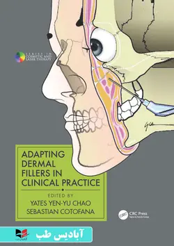 Adapting Dermal Fillers in Clinical Practice (Series in Cosmetic and Laser Therapy) 1st Edition | تطبیق پرکننده های پوستی در عمل بالینی (سری در زیبایی و لیزر درمانی) ویرایش اول