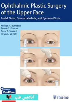 Ophthalmic Plastic Surgery of the Upper Face: Eyelid Ptosis, Dermatochalasis, and Eyebrow Ptosis  | جراحی پلاستیک چشم فوقانی صورت: پتوز پلک، درماتوکالازیس و پتوز ابرو