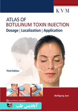 Atlas of Botulinum Toxin Injection, Dosage, Localization, Application, 3rd Edition 3rd Edition | اطلس تزریق سم بوتولینوم، دوز، محلی سازی، کاربرد، ویرایش سوم ویرایش سوم