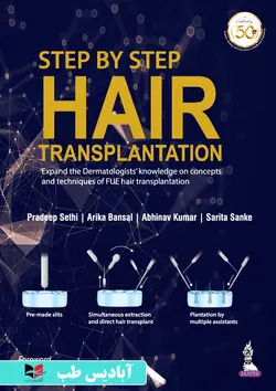 Step by Step Hair Transplantation | گام به گام کاشت مو