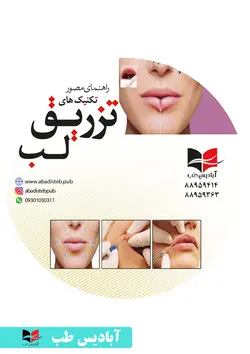 ویدئو های راهنمای مصور تکنیک های تزریق فیلر لب