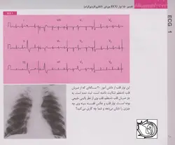 کتاب ECG کاربردی | ویرایش هفتم - 2019 | ترجمه دکتر منوچهر قارونی | نشر اشراقیه