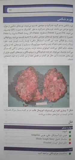 خرید کتاب تشخیص افتراقی چرچیل 2022 | با تخفیف ویژه | اشراقیه