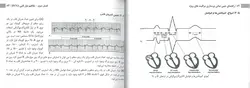 کتاب کتاب راهنمای جیبی مبانی پرستاری مراقبت ویژه AACN | نشر اشراقیه