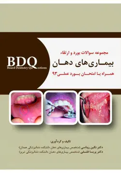 خرید کتاب BDQ مجموعه سوالات بورد و ارتقاء بیماری های دهان (همراه با امتحان بورد عملی 93) | نشر اشراقیه