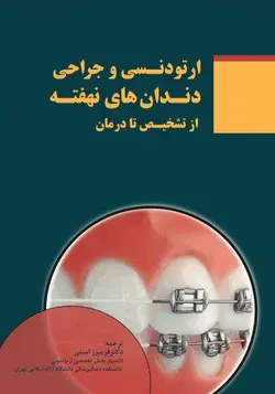 خرید کتاب ارتودنسی و جراحی دندان های نهفته از تشخیص تا درمان | نشر اشراقیه