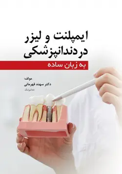 کتاب ایمپلنت و لیزر در دندانپزشکی به زبان ساده | نشر اشراقیه