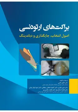 خرید کتاب براکت های ارتودنسی اصول انتخاب، جایگذاری و دباندینگ | نشر اشراقیه