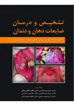 خرید کتاب تشخیص و درمان ضایعات دهان و دندان | نشر اشراقیه
