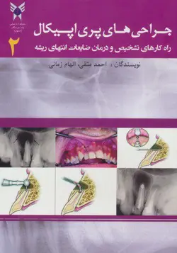 کتاب جراحی های پری اپیکال 2 (راهکارهای تشخیص و درمان ضایعات انتهای ریشه) | نشر اشراقیه