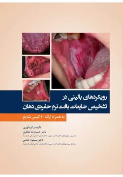 خرید کتاب رویکردهای بالینی در تشخیص ضایعات بافت نرم حفره ی دهان | نشر اشراقیه